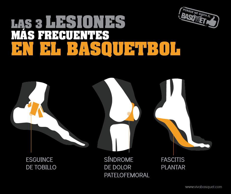 Las tres lesiones mas frecuentes en el Basquetbol por Viva Basquet